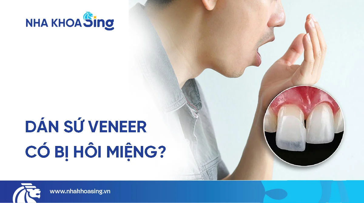 Dán sứ veneer có bị hôi miệng không? Cách xử lý triệt để