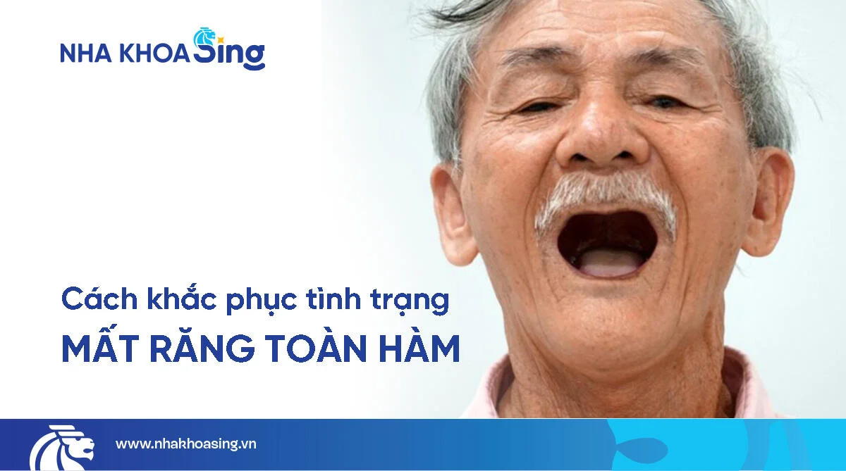 Mất răng toàn hàm: Nguyên nhân, hậu quả và giải pháp khắc phục