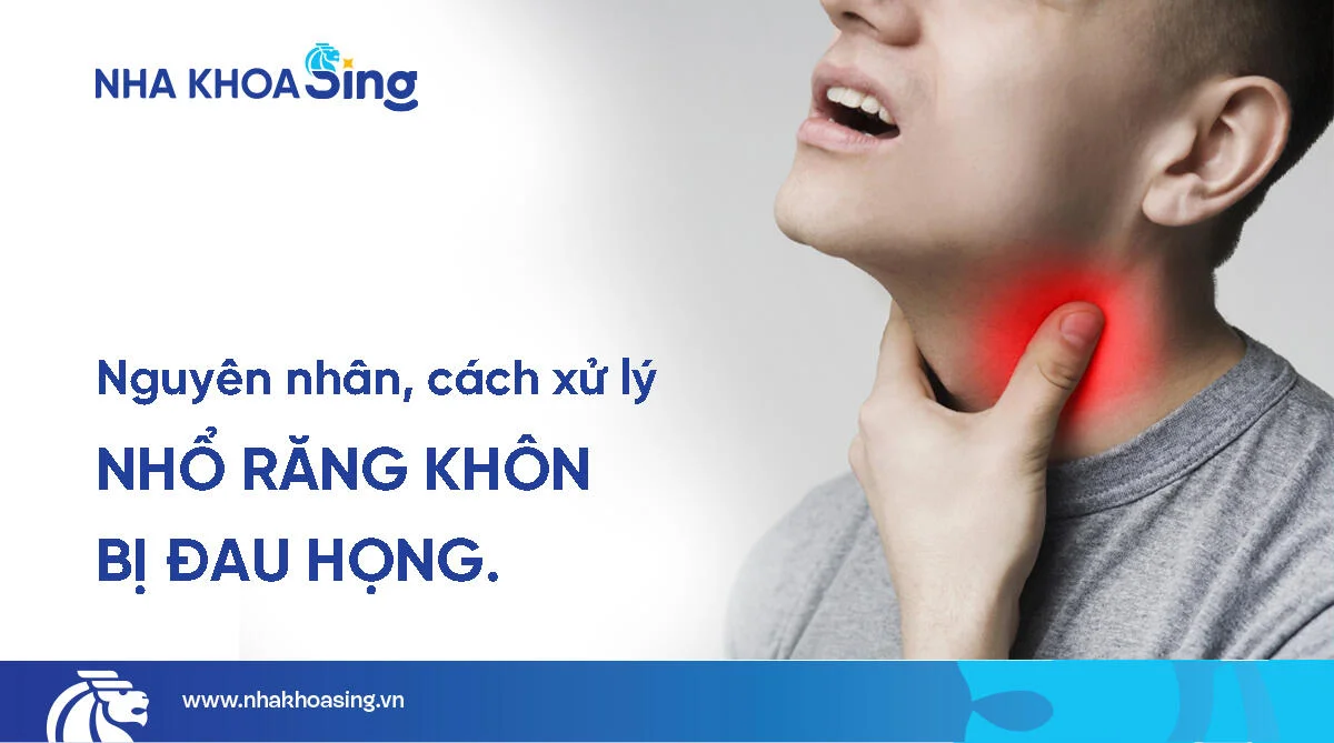 Vì sao nhổ răng khôn bị đau họng? Cách giảm đau hiệu quả