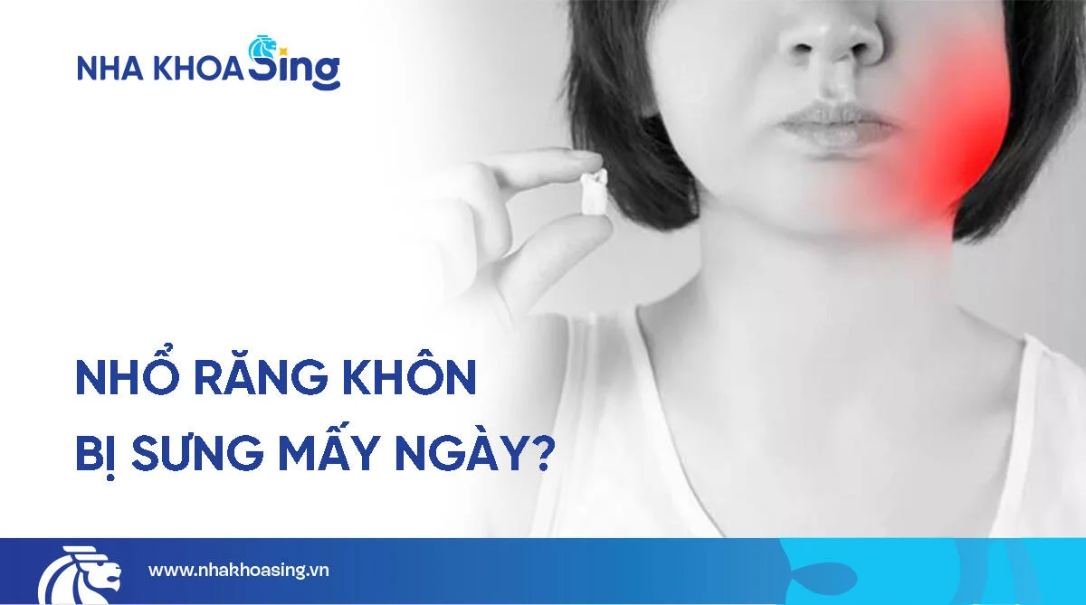 Nhổ răng khôn sưng mấy ngày? Cách giảm sưng nhanh chóng