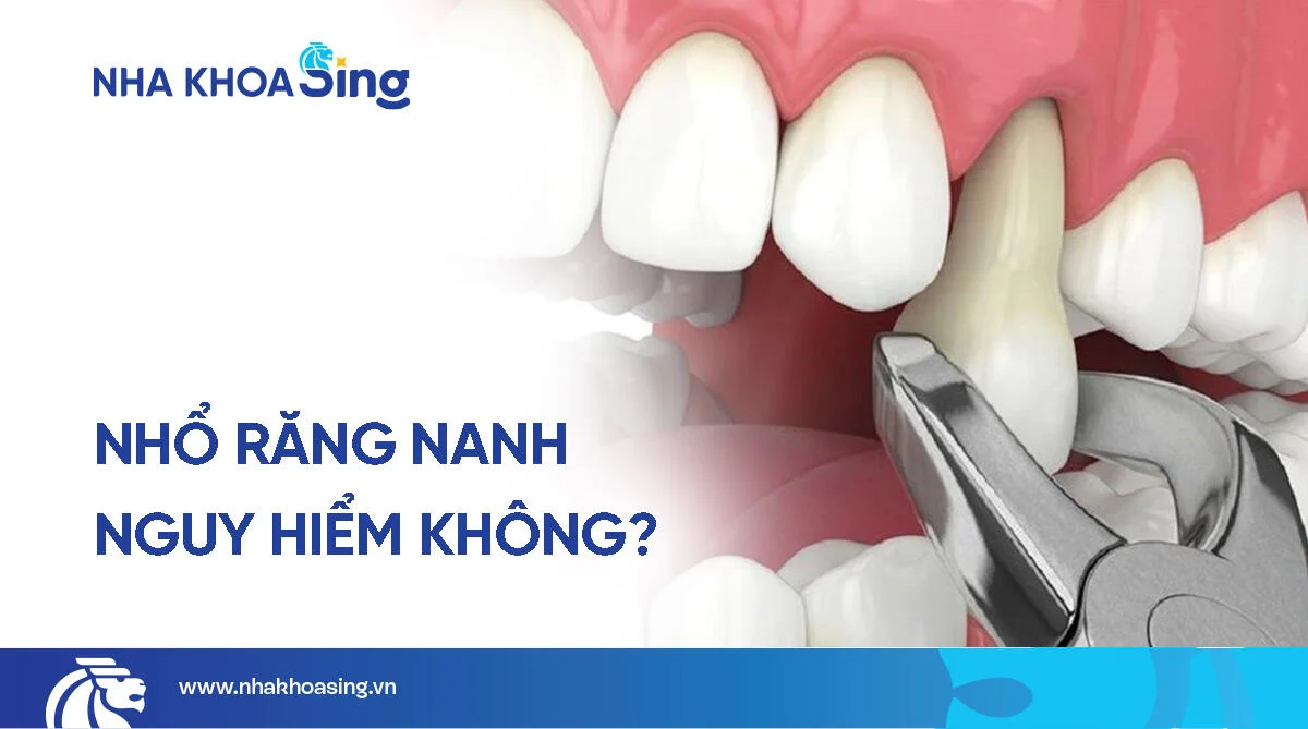 Nhổ răng nanh có nguy hiểm không? Giải đáp từ chuyên gia