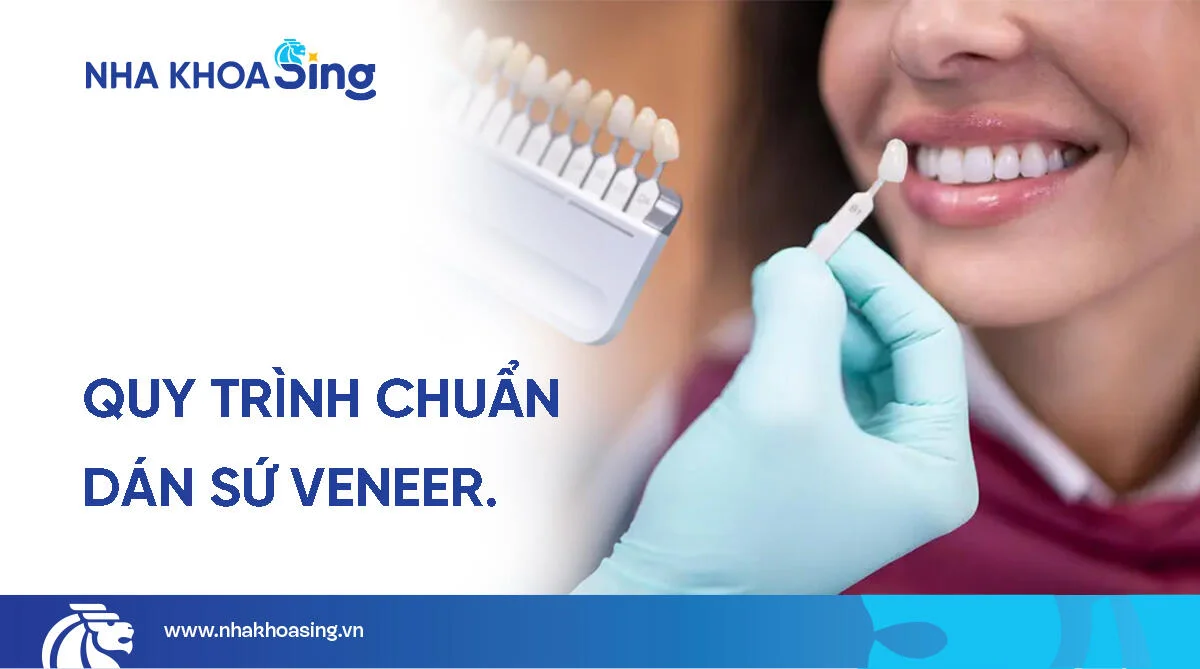 Quy trình dán sứ veneer chuẩn y khoa tại Nha khoa Sing