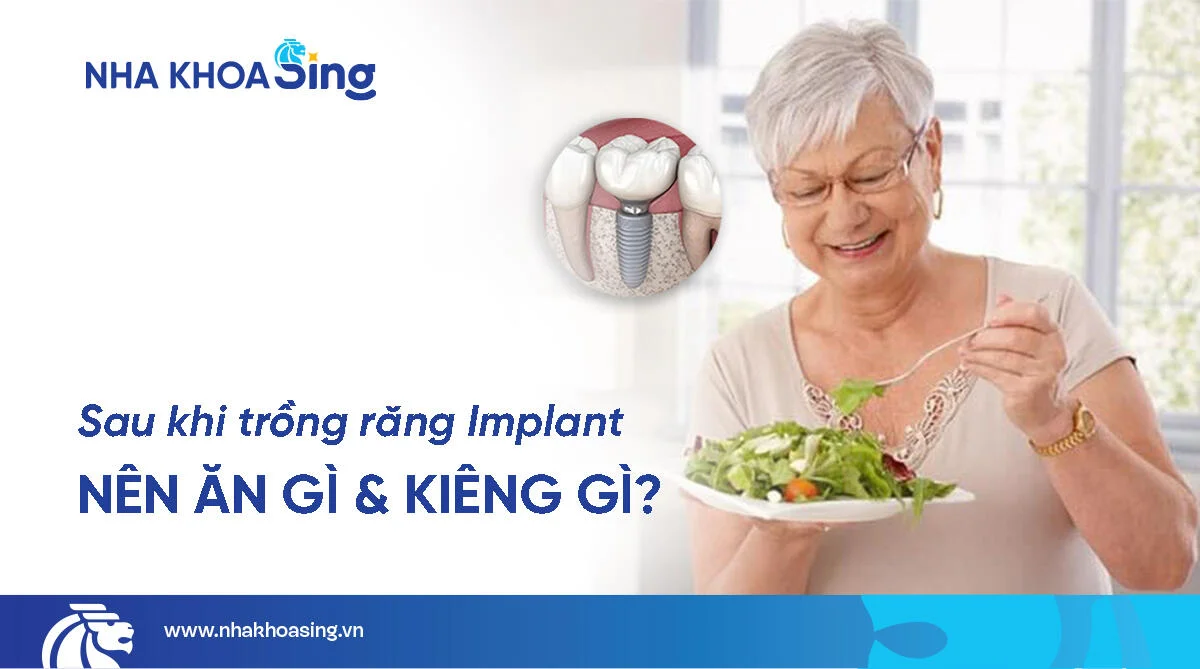 Sau khi trồng răng Implant nên ăn gì và kiêng gì?
