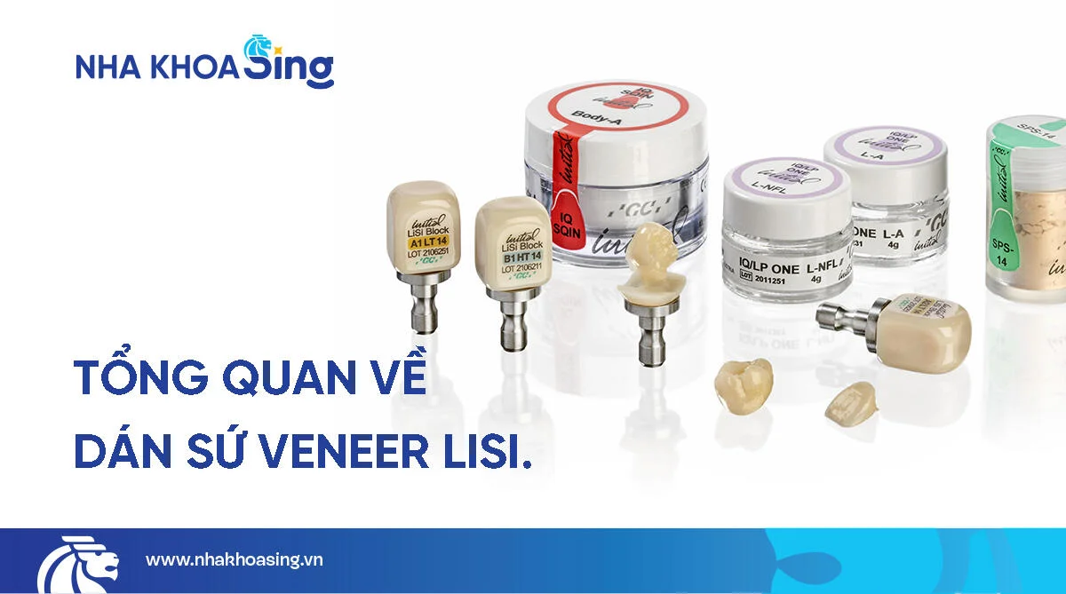 Dán veneer Lisi: Giải pháp thẩm mỹ răng tự nhiên và bền đẹp