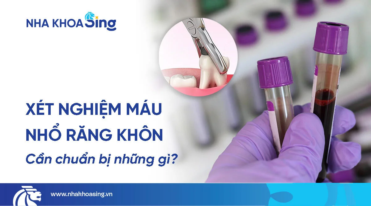 Xét nghiệm máu nhổ răng khôn: Có cần thiết không?