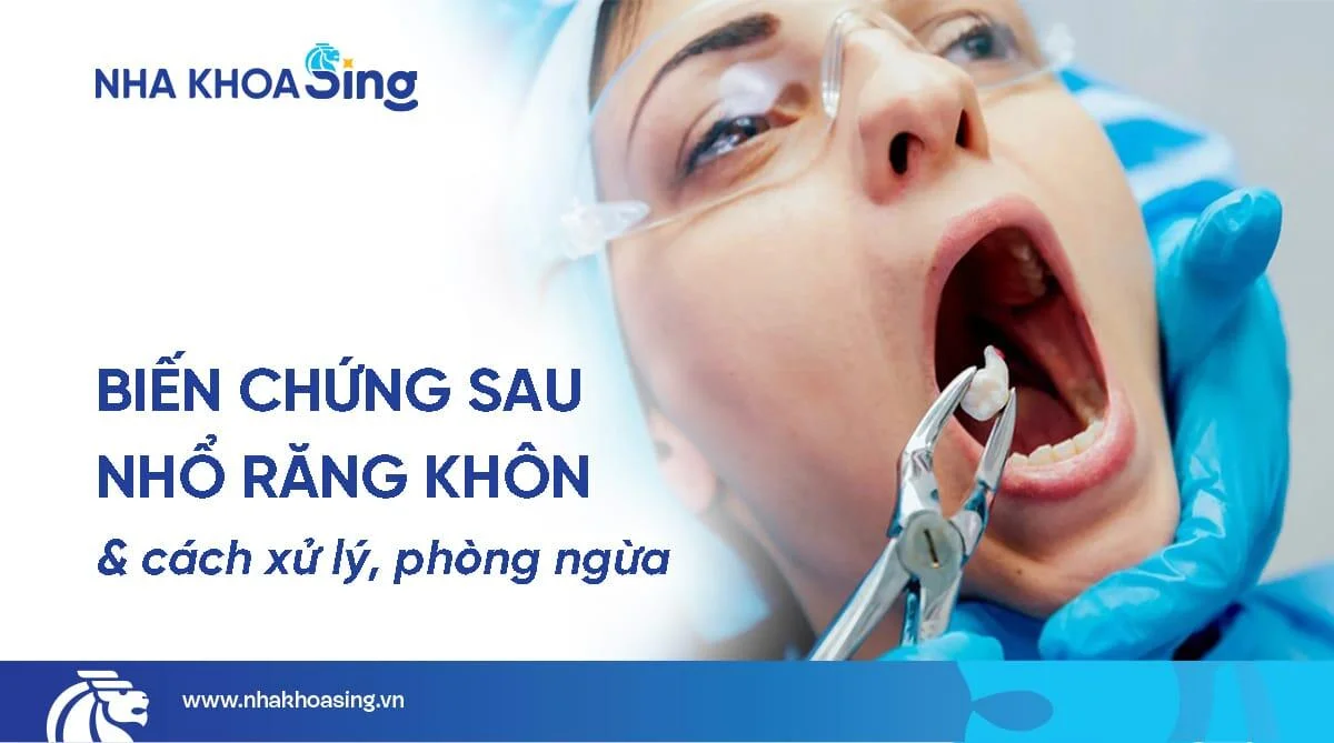 Cảnh báo các biến chứng sau khi nhổ răng khôn & cách phòng ngừa