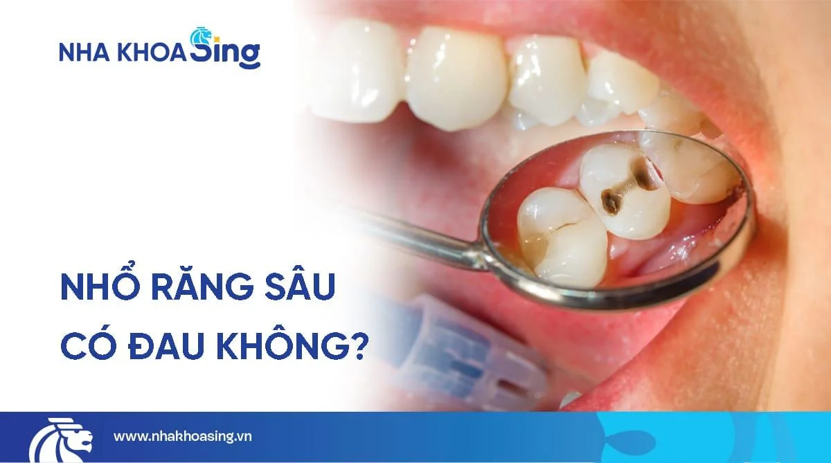 Nhổ răng sâu có đau không? 10 điều cần biết khi nhổ răng sâu