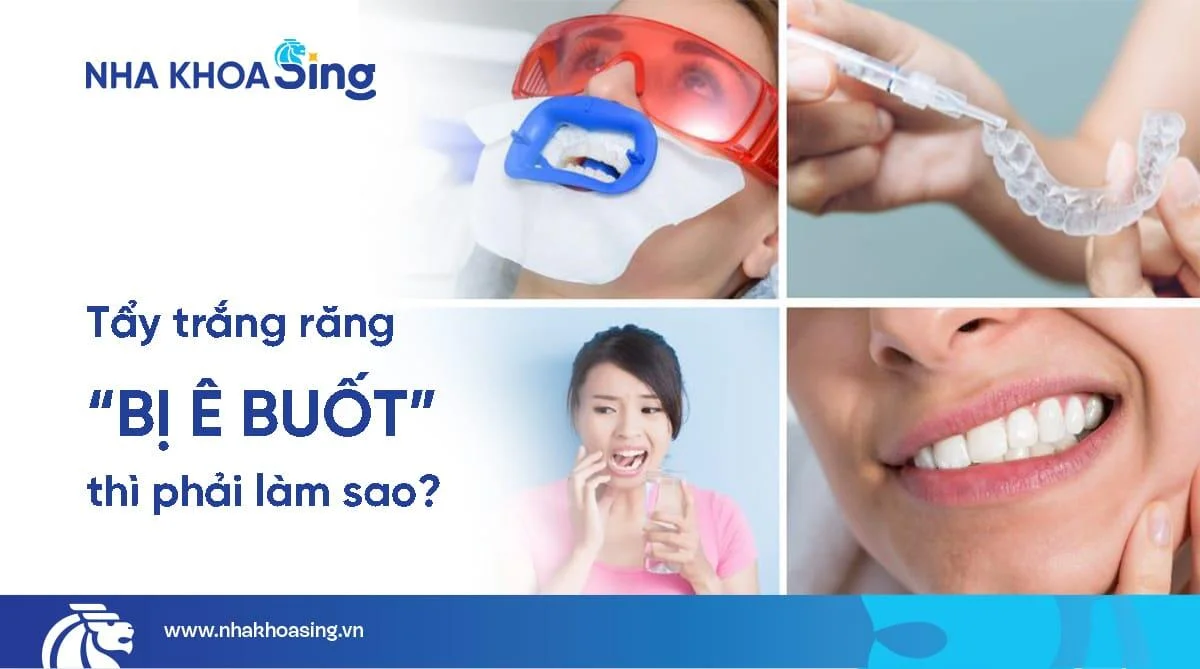 Tẩy trắng răng bị ê buốt: Nguyên nhân và cách khắc phục nhanh, an toàn