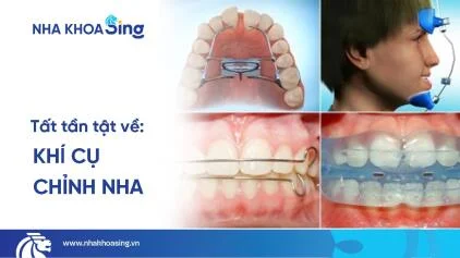 Khí cụ chỉnh nha: Tác dụng, phân loại và lưu ý khi dùng cho trẻ