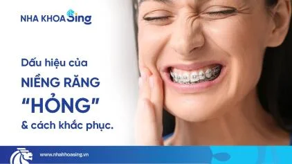 Niềng răng hỏng: Dấu hiệu nhận biết và cách khắc phục an toàn