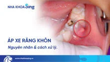 ap-xe-rang-khon-thumbnailjpeg