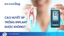 cao-huyet-ap-co-trong-rang-implant-duoc-khong-thumbnail