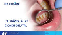 cao-rang-thumbnail