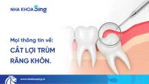 cat-loi-trum-rang-khon-thumbnail