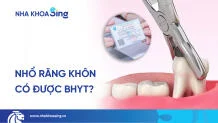 chi-phi-nho-rang-khon-co-bao-hiem-y-te