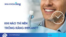 khi-nao-thi-trong-rang-implant-thumbnail
