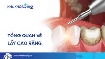 lay-cao-rang-thumbnail