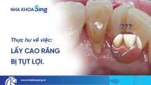 lay-cao-rang-xong-bi-tut-loi-thumbnail