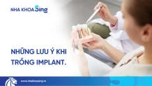 luu-y-khi-trong-rang-implant-thumbnail