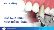 nho-rang-nanh-co-nguy-hiem-khong-thumbnail-1