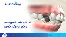 nho-rang-so-4-thumbnail