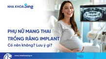 phu-nu-mang-thai-co-nen-trong-rang-implant-thumbnail