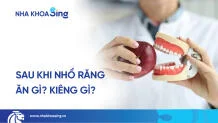 sau-khi-nho-rang-nen-an-gi-thumbnail