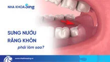 sung-nuou-rang-khon-thumbnail