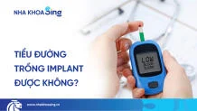 tieu-duong-trong-rang-implant-duoc-khong-thumbnail-1
