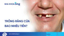 trong-rang-cua-bao-nhieu-tien-thumbnail