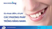 trong-rang-nanh-thumbnail