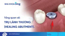 tru-lanh-thuong-la-gi-thumbnail