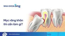 moc-rang-khon-thumbnail