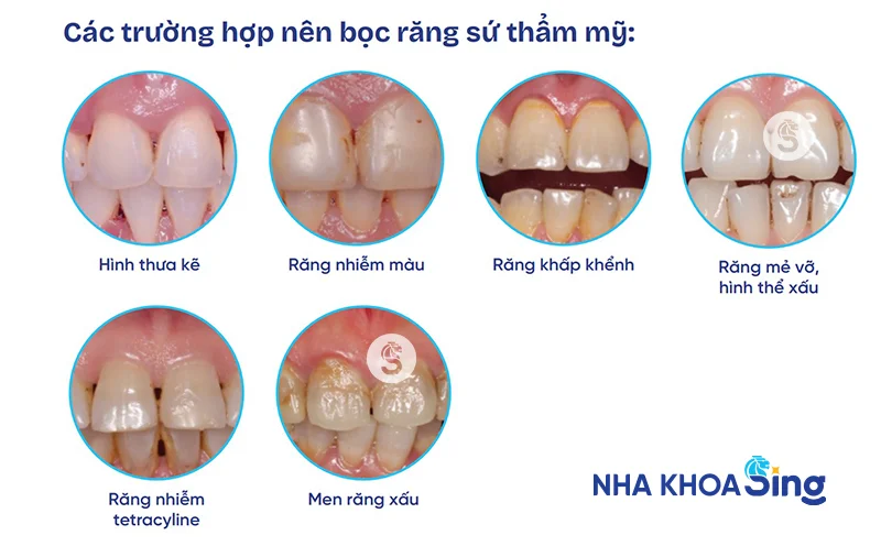 boc-rang-su-5