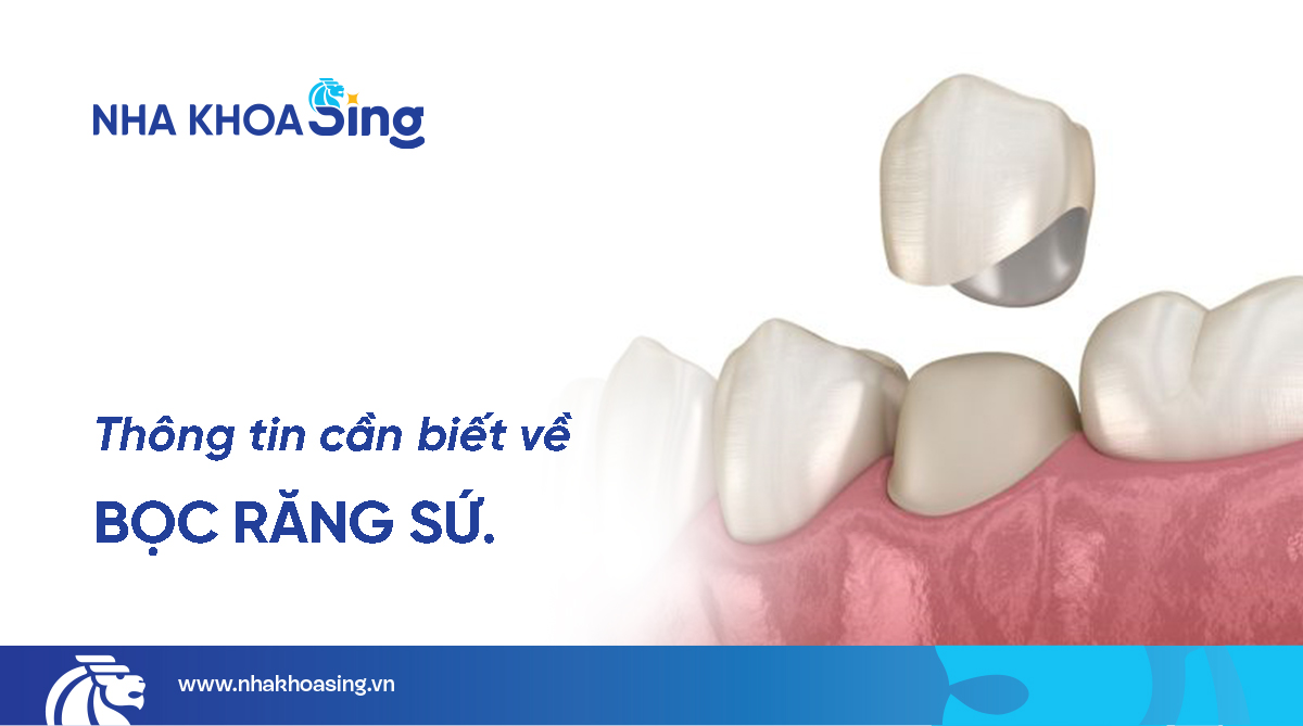 Bọc răng sứ – Giải pháp phục hình thẩm mỹ và bảo vệ răng toàn diện 
Bọc răng sứ là một trong những p...