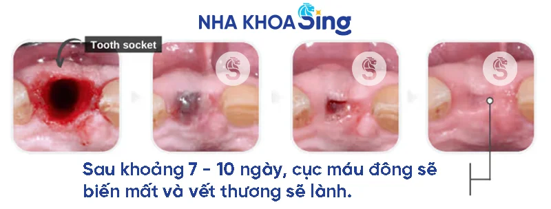cuc-mau-dong-sau-nho-rang-1