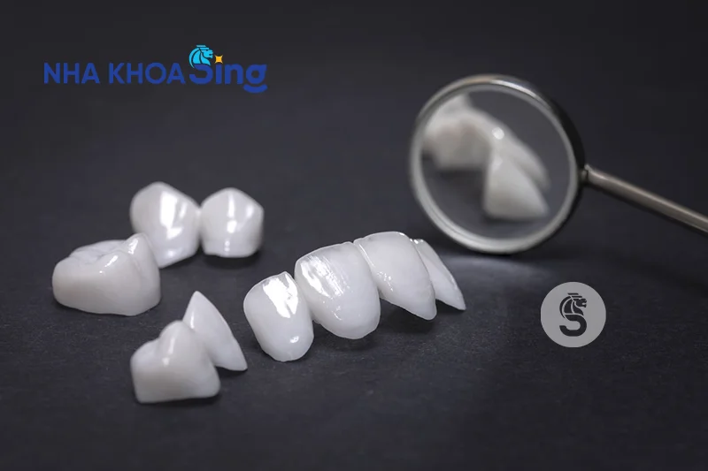 dan-su-veneer-co-ben-khong