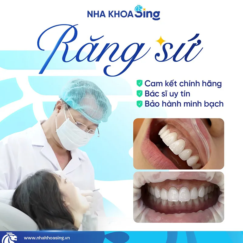 dan-su-veneer-co-bi-hoi-mieng-khong-2
