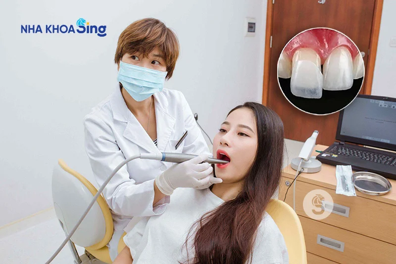 dang-mang-thai-co-nen-thuc-hien-dan-su-veneer-1