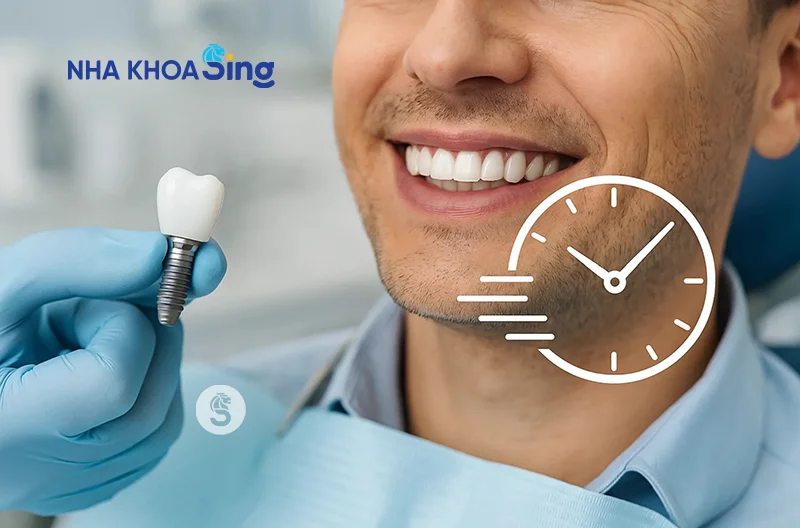 khi-nao-thi-trong-rang-implant-1
