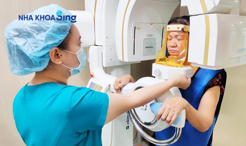 luu-y-khi-trong-rang-implant-1