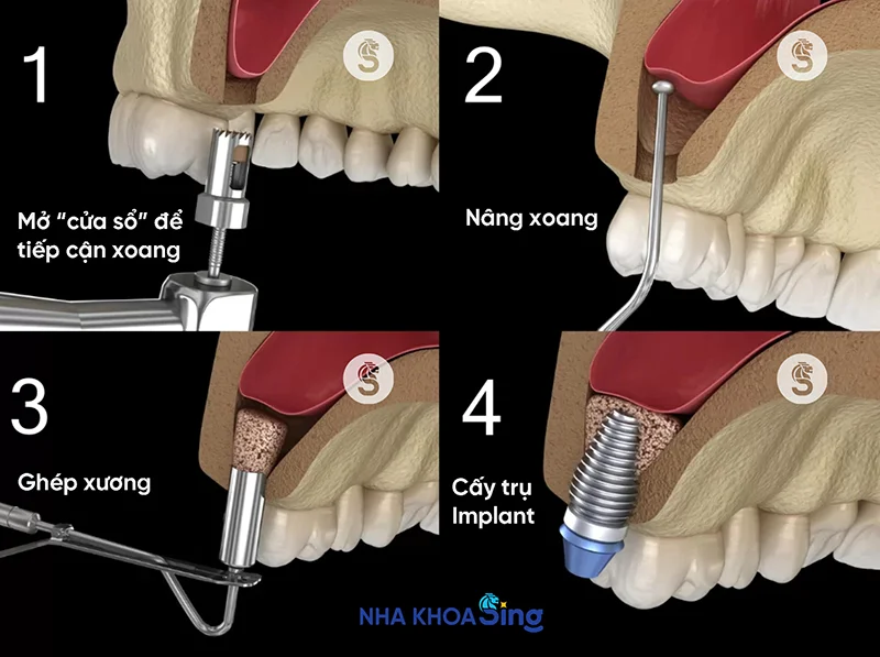 nang-xoang-ho