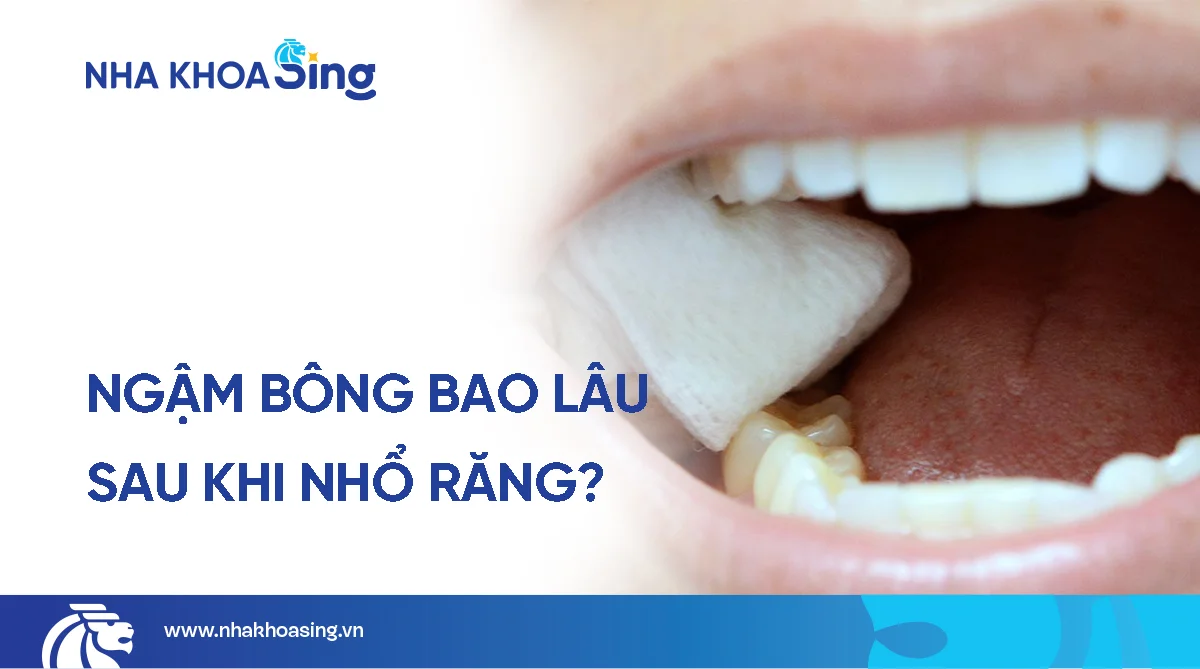 Ngậm bông bao lâu sau khi nhổ răng? Hướng dẫn chăm sóc sau nhổ răng