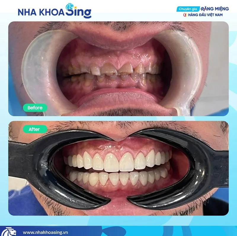 nha-khoa-thai-binh-4
