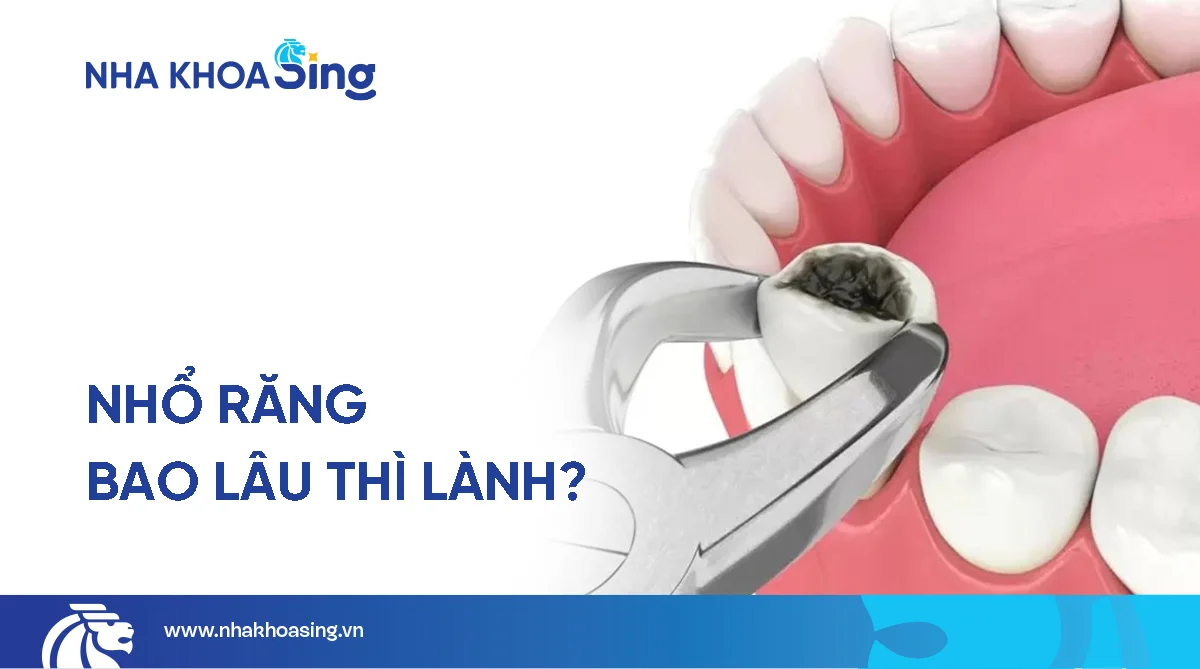 Nhổ răng bao lâu thì lành? Làm sao để mau lành thương