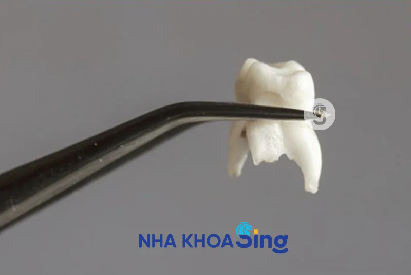 nho-rang-con-sot-chan-rang-co-sao-khong-2