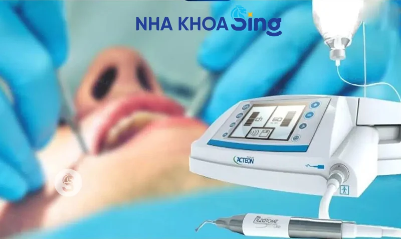 nho-rang-khon-bao-lau-thi-lanh-1