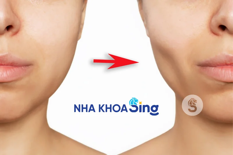 nho-rang-khon-co-bi-hop-ma-khong-1