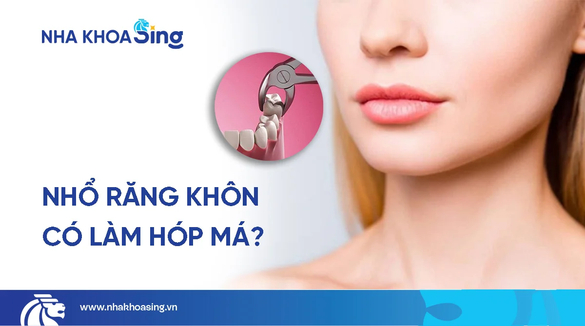 Nhổ răng khôn có bị hóp má không? Giải đáp chi tiết