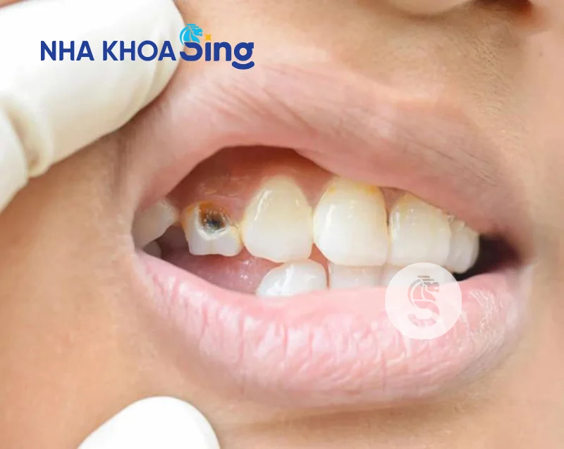 nho-rang-nanh-co-nguy-hiem-khong-1
